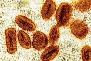 Rondônia Registra Novos Casos de Mpox e Total Chega a Seis