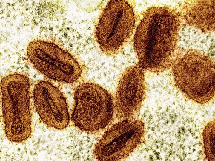 Rondônia Registra Novos Casos de Mpox e Total Chega a Seis