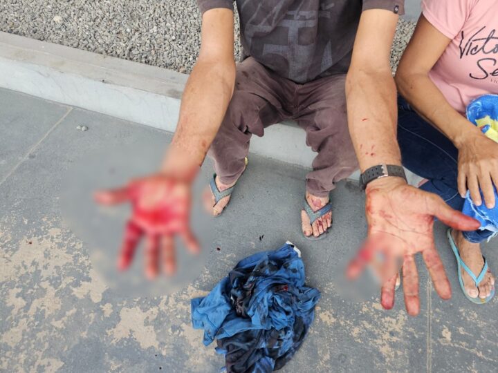 Homem é Ferido com Facão Após Recusar Oferecimento de Cigarro em Boa Vista