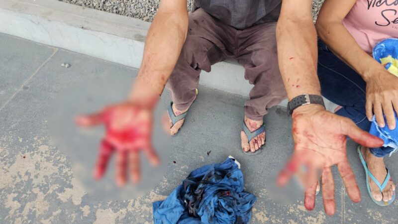 Homem é Ferido com Facão Após Recusar Oferecimento de Cigarro em Boa Vista