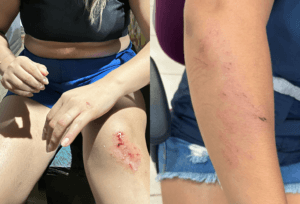 Ataque a Técnica de enfermagem na Terra Yanomami e retirada de equipe pelo Ministério