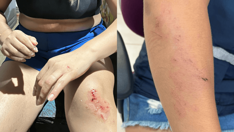 Ataque a Técnica de enfermagem na Terra Yanomami e retirada de equipe pelo Ministério