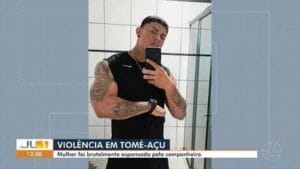 Mulher em estado crítico após agressão brutal em Tomé-Açu