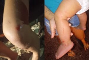 Violência Doméstica em Roraima: Homem Agride Ex-Companheira e Filho de 9 Meses