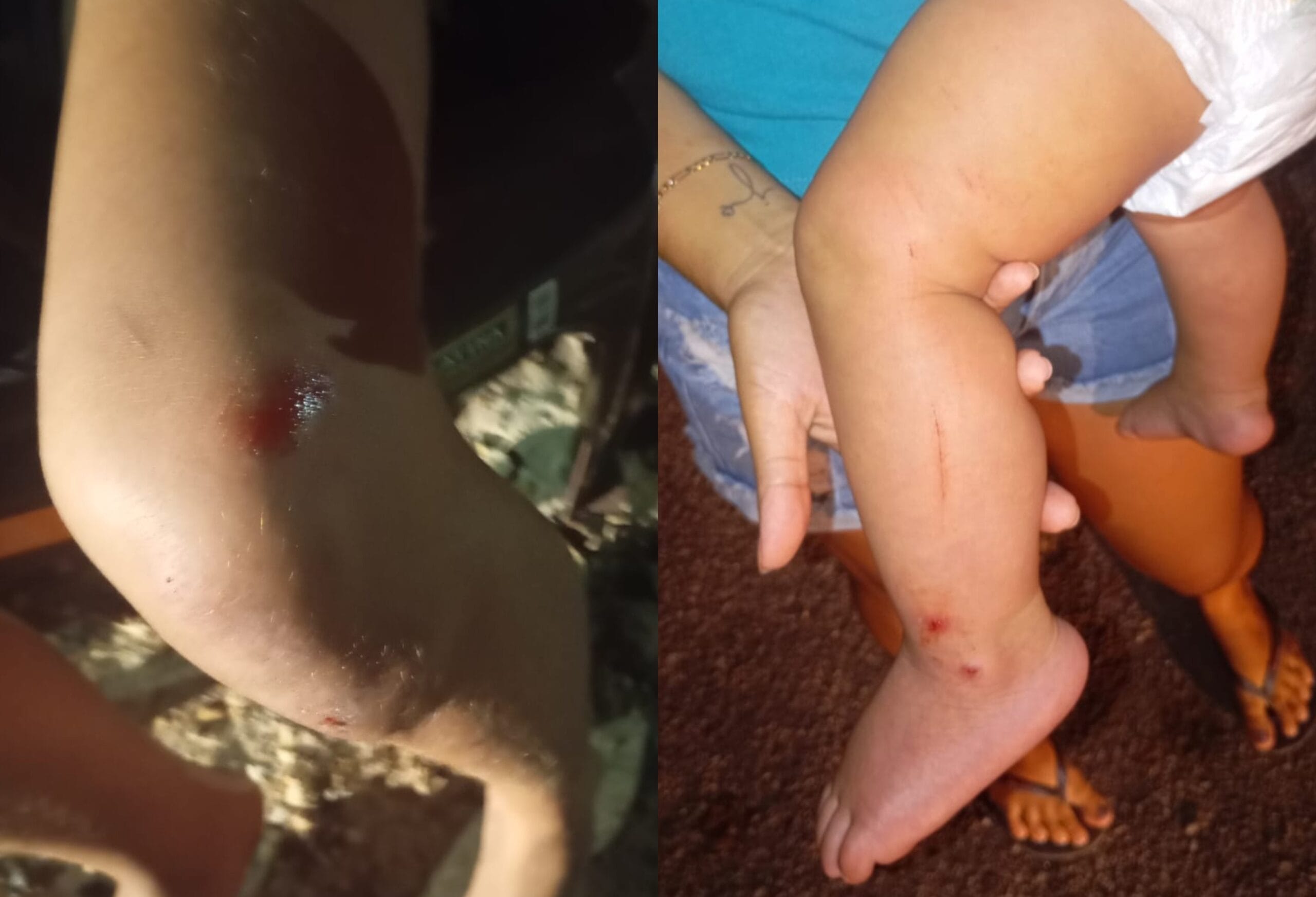 Violência Doméstica em Roraima: Homem Agride Ex-Companheira e Filho de 9 Meses