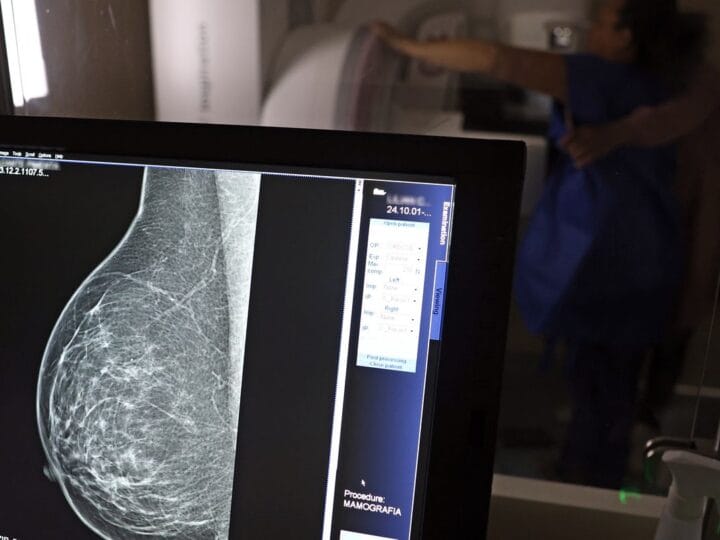 Nova Lei Garante Folgas para Exames Preventivos de Câncer e HPV