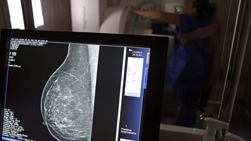 Nova Lei Garante Folgas para Exames Preventivos de Câncer e HPV