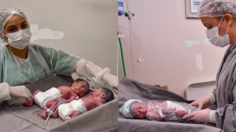 Nascimento Inusitado de Trigêmeos é Registrado em Manaus