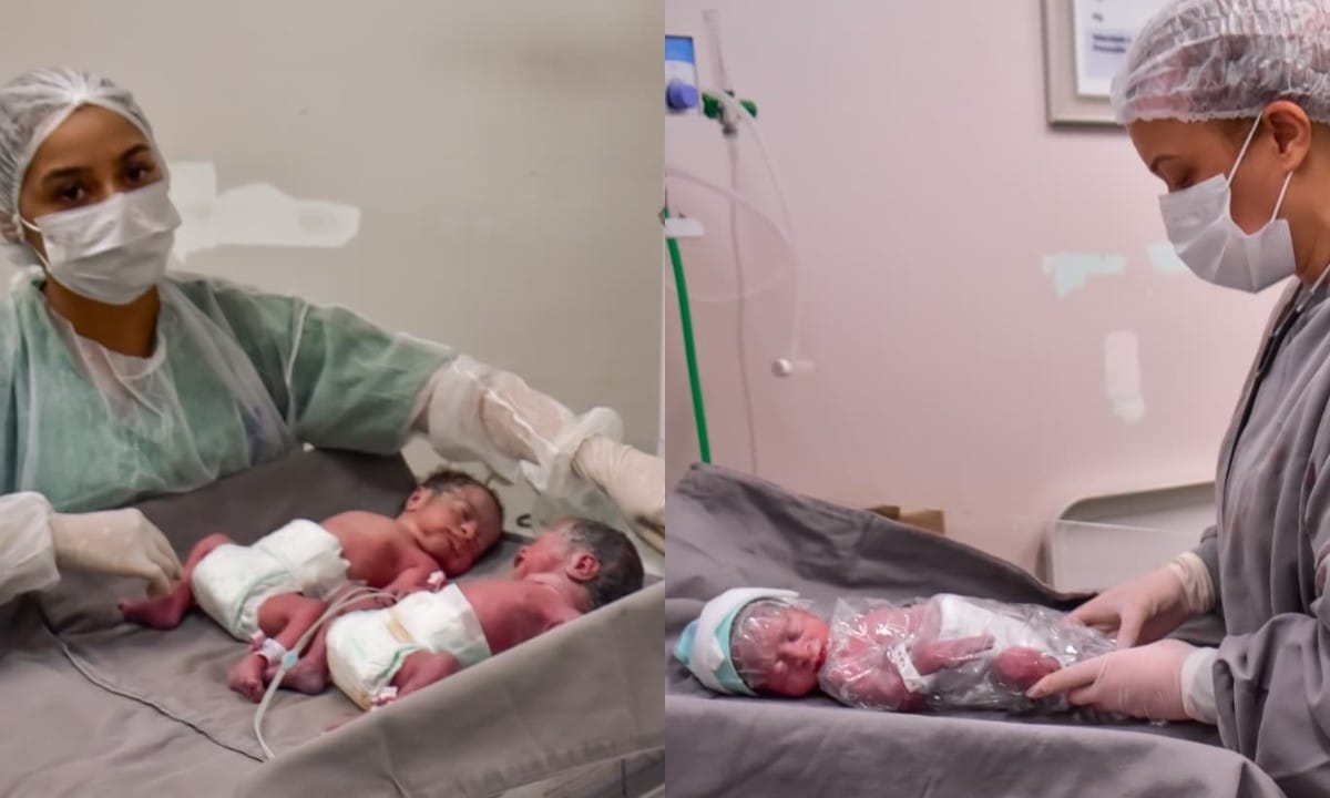 Nascimento Inusitado de Trigêmeos é Registrado em Manaus