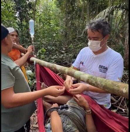 Indígena do Povo Zo’é Resgatado Após Acidente com Flecha Durante Caçada na Amazônia