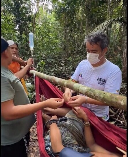 Indígena do Povo Zo’é Resgatado Após Acidente com Flecha Durante Caçada na Amazônia