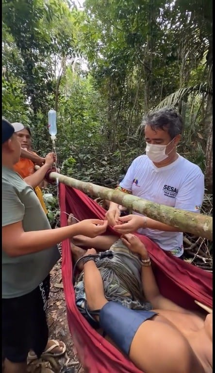 Indígena do Povo Zo’é Resgatado Após Acidente com Flecha Durante Caçada na Amazônia