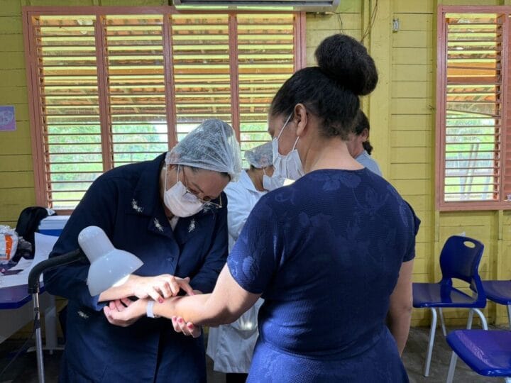 Seis Casos de Tuberculose Latente Identificados em Comunidade Rural de Macapá