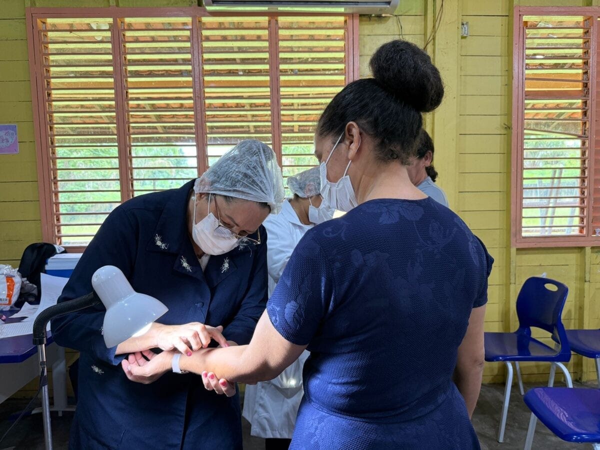 Seis Casos de Tuberculose Latente Identificados em Comunidade Rural de Macapá