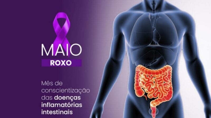 Maio Roxo: Alerta para Doenças Inflamatórias Intestinais