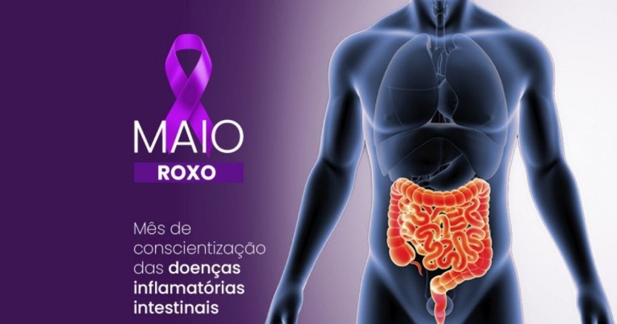 Maio Roxo: Alerta para Doenças Inflamatórias Intestinais