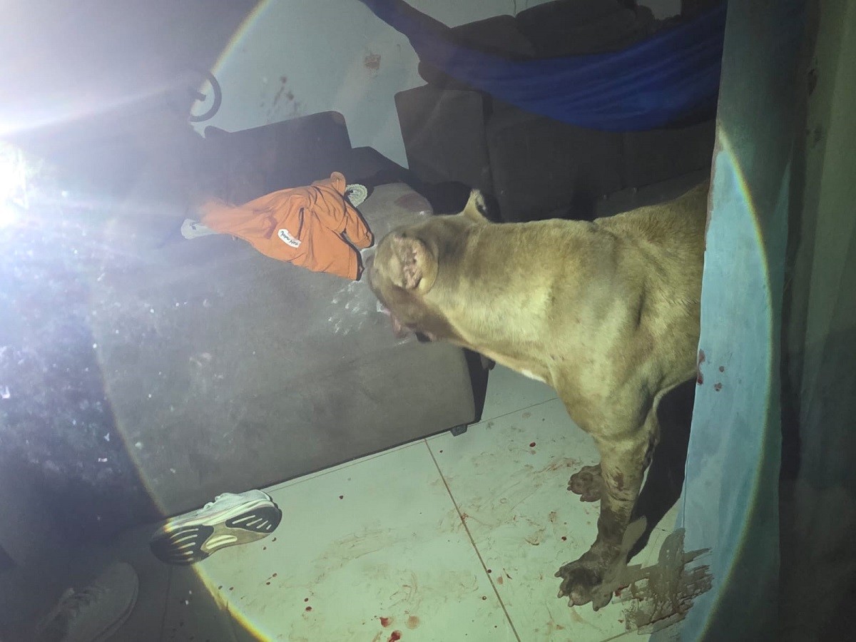 Estado de Saúde de Menino Atacado por Pitbull em Santarém é Estável Após Cirurgia