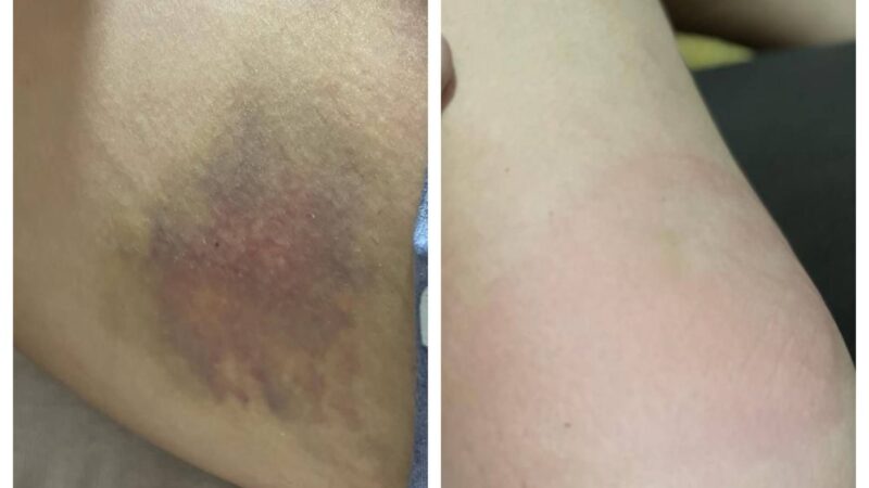 Influenciador é Condenado a 13 Anos por Violência Doméstica em Rondônia