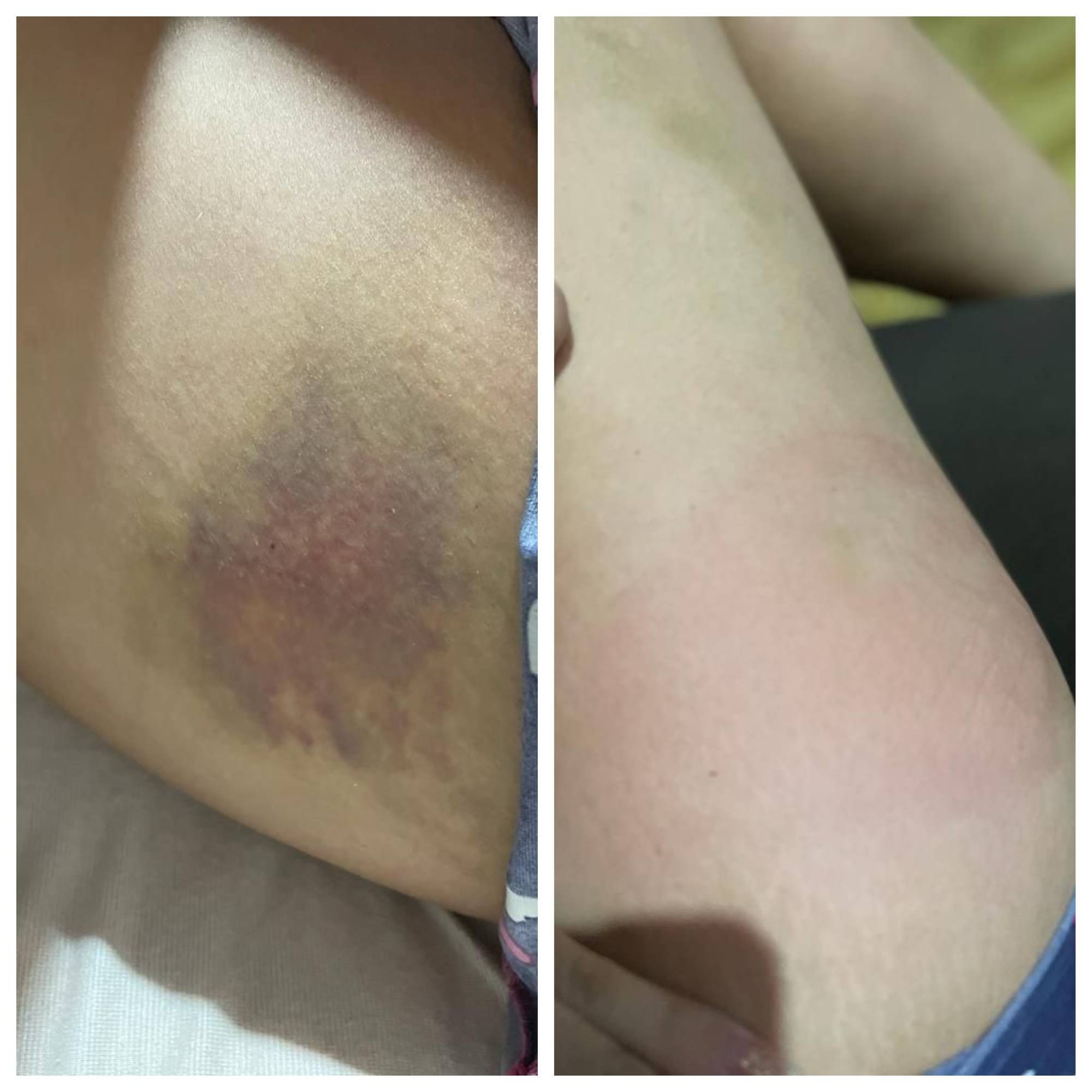 Influenciador é Condenado a 13 Anos por Violência Doméstica em Rondônia