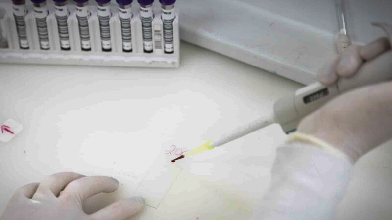 Homem em São Paulo Testa Positivo para Meningite Após Suspeita de Ebola
