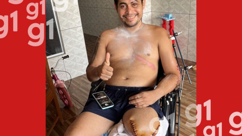 Motociclista Enfrenta Desafios Financeiros Após Acidente Grave no Acre