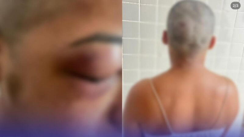Ciclo de Violência em Almeirim: Mulher Sofre Agressão e Tentativa de Homicídio