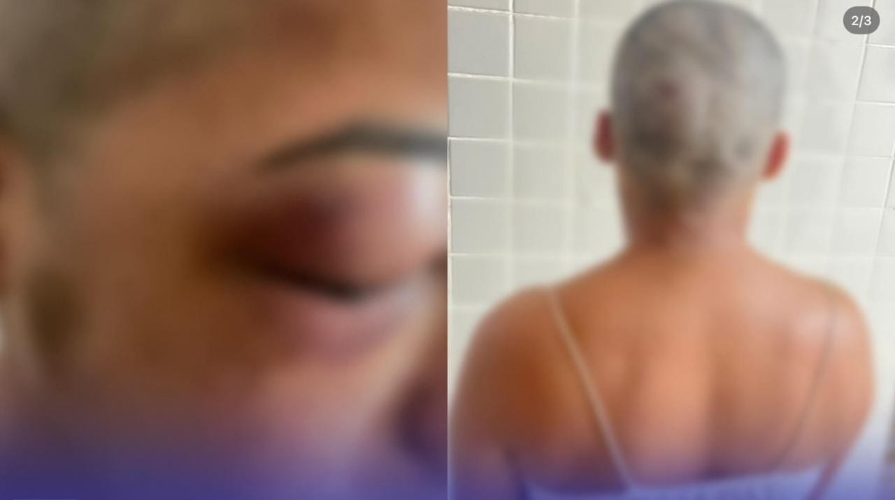 Ciclo de Violência em Almeirim: Mulher Sofre Agressão e Tentativa de Homicídio