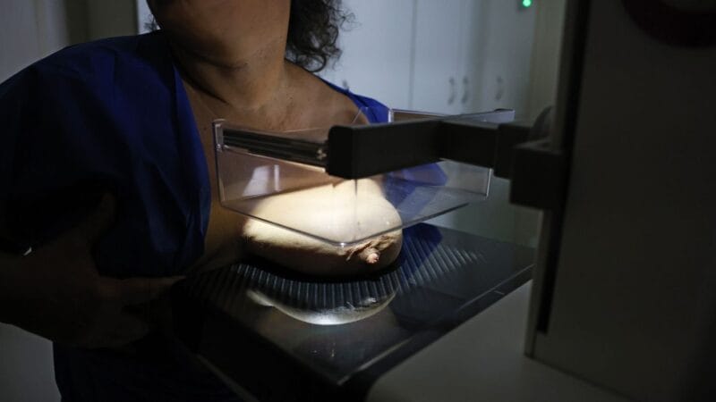 ANS Propõe Ampliação na Cobertura da Mamografia Digital para Todos os Gêneros e Idades