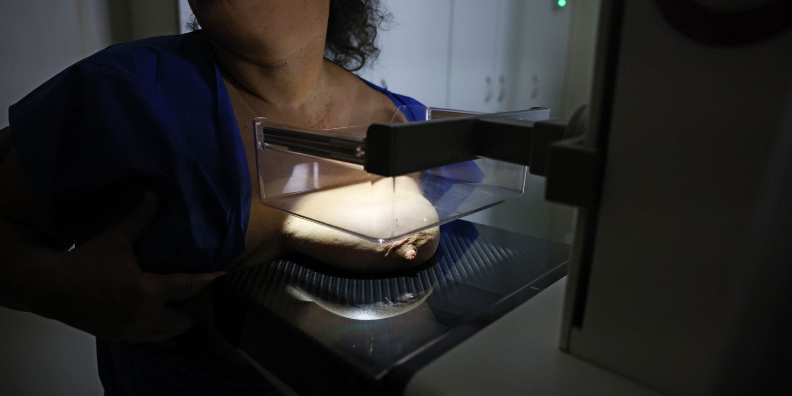 ANS Propõe Ampliação na Cobertura da Mamografia Digital para Todos os Gêneros e Idades