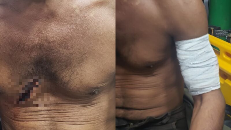 Caseiro é Atacado com Facão em Alto Alegre e Fica Ferido