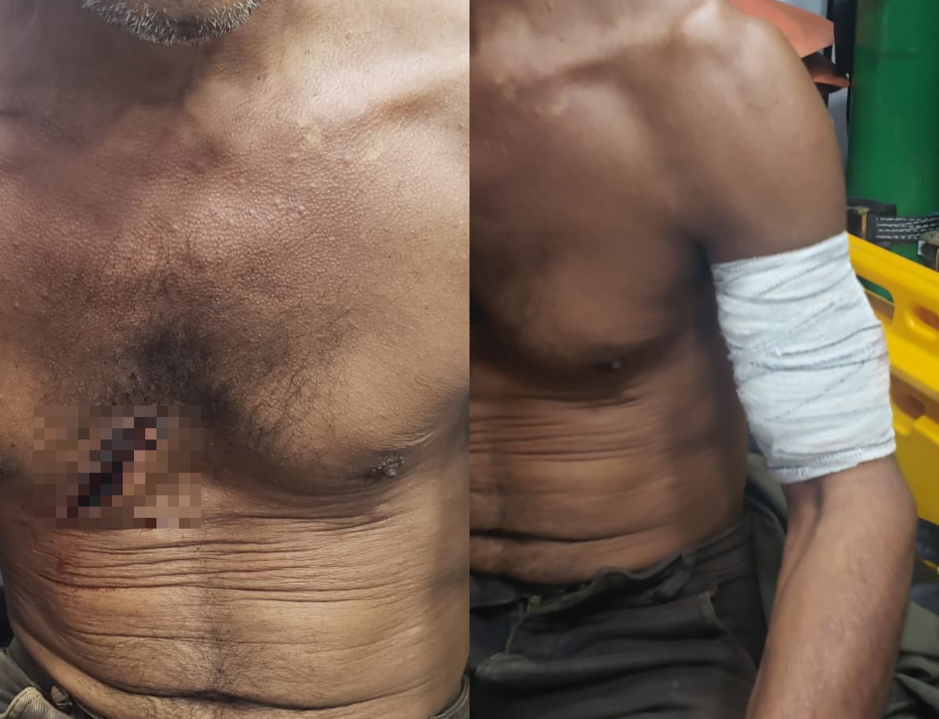 Caseiro é Atacado com Facão em Alto Alegre e Fica Ferido