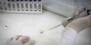 Exames Confirmam Ausência de Ebola em Imigrante Congolês em São Paulo