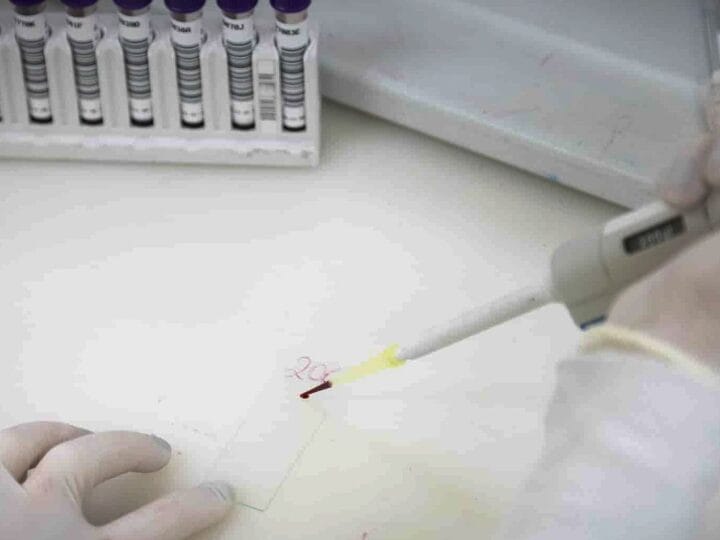 Exames Confirmam Ausência de Ebola em Imigrante Congolês em São Paulo