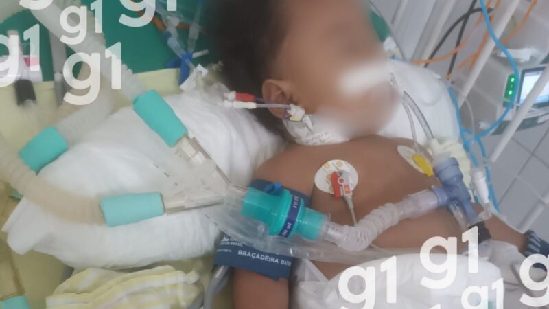 Família de Bebê no Acre Enfrenta Desafios em Busca de Diagnóstico para Convulsões