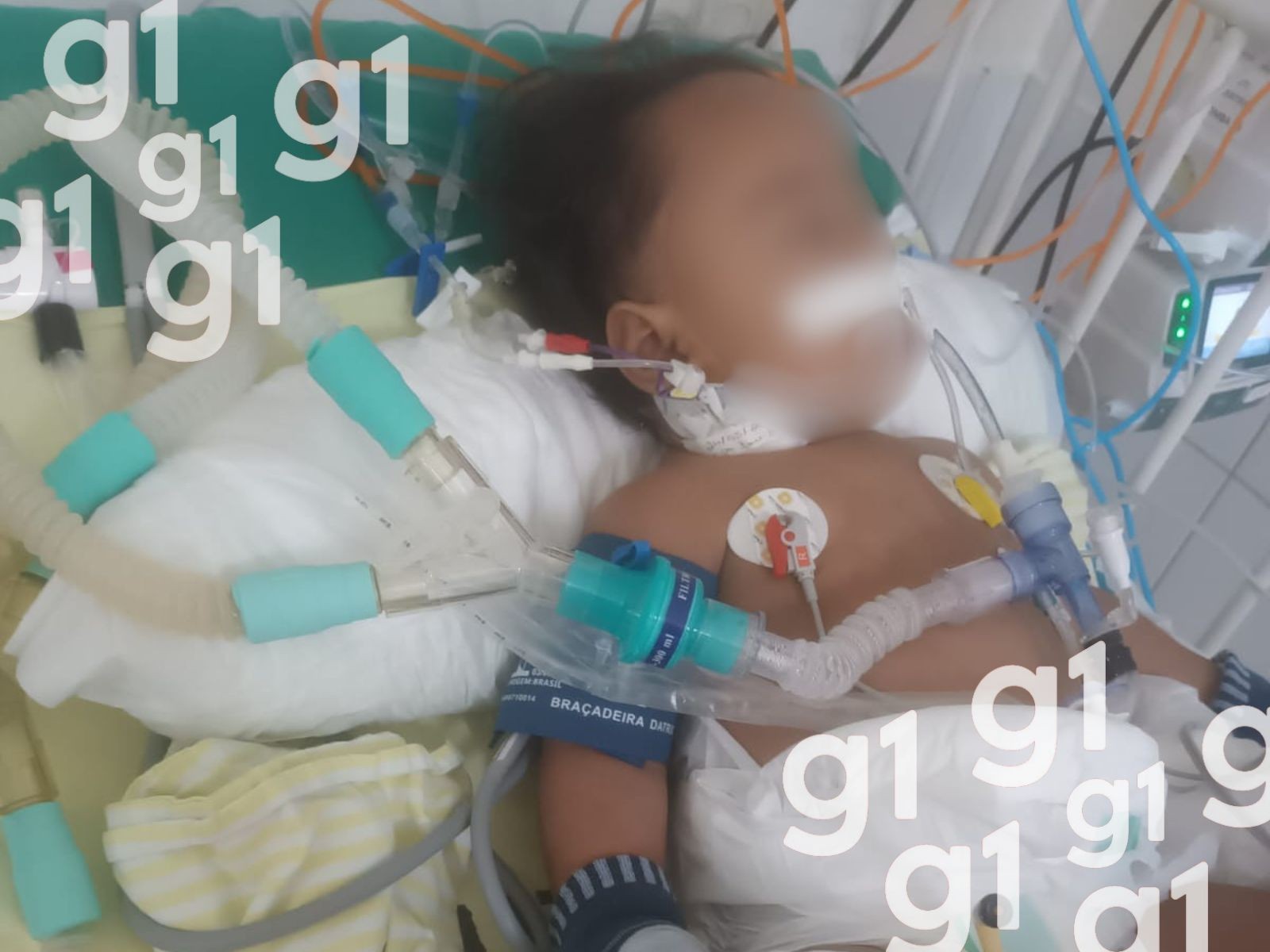 Família de Bebê no Acre Enfrenta Desafios em Busca de Diagnóstico para Convulsões