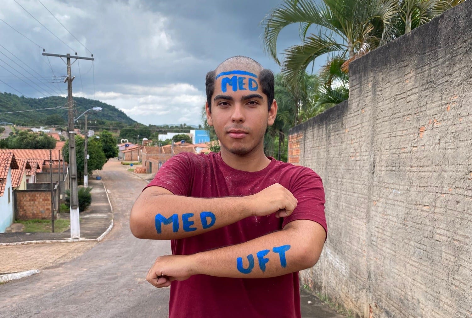 Da Roça à Medicina: A Inspiração de Fernando Abreu na UFT