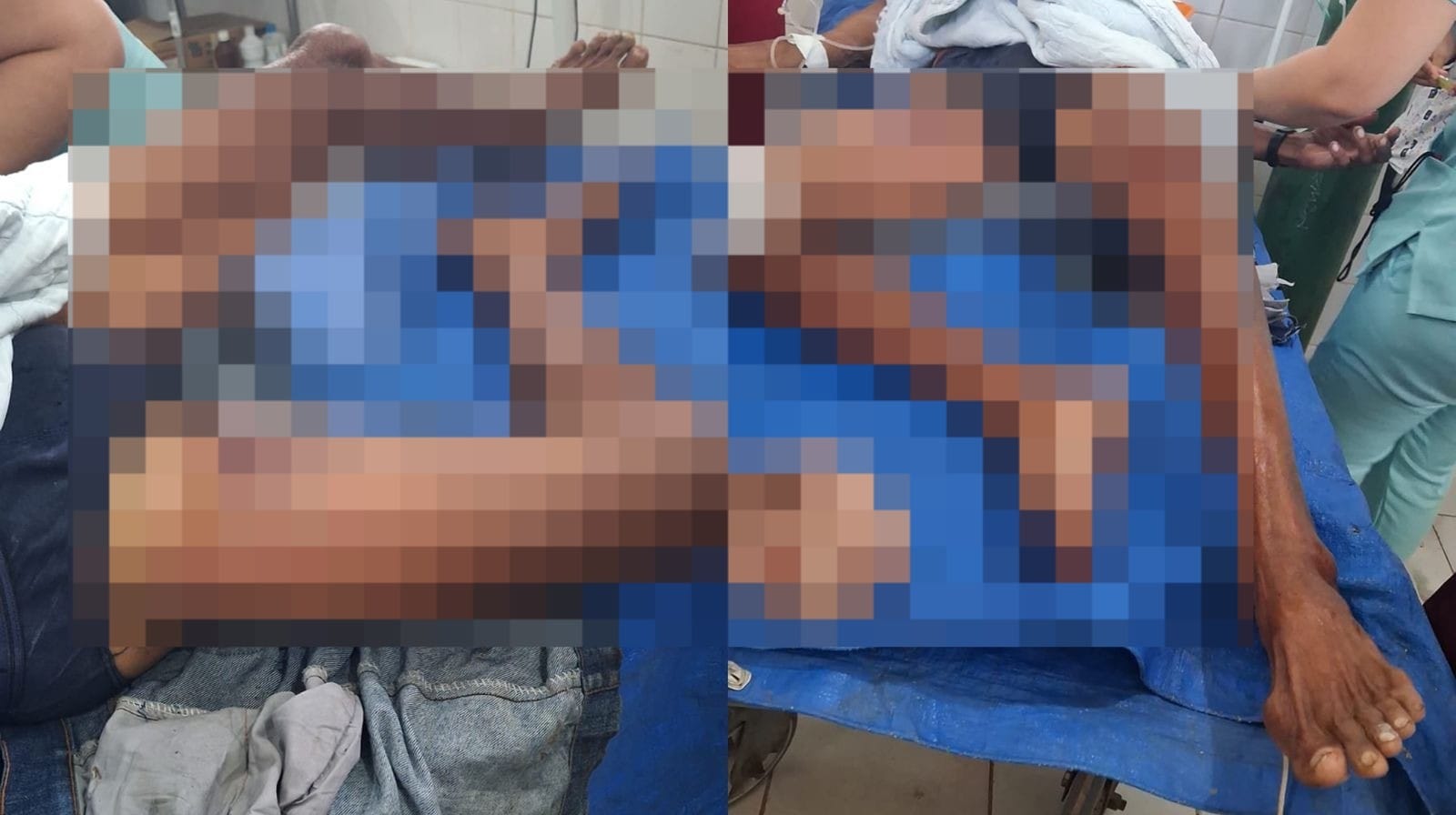 Idoso encontrado amarrado em Óbidos morre e polícia investiga latrocínio