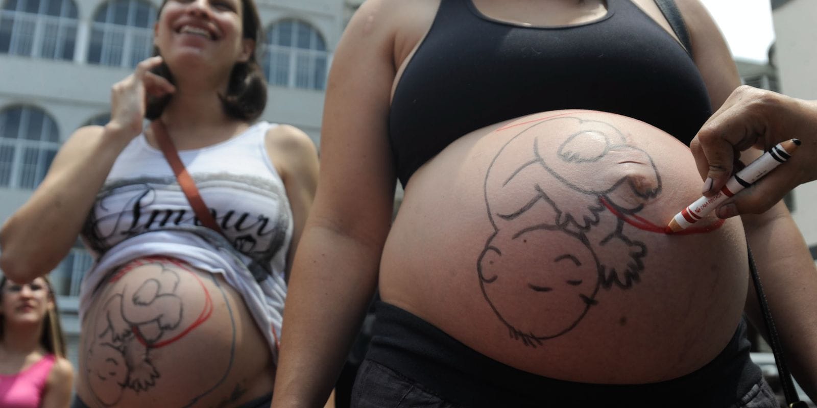 Análise das Cesarianas no Brasil: Fatores Sociais e Estruturais