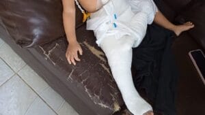 Denúncia de Lesão Corporal em Manaus: Mãe é Acusada Após Filha Sofrer Fratura na Perna