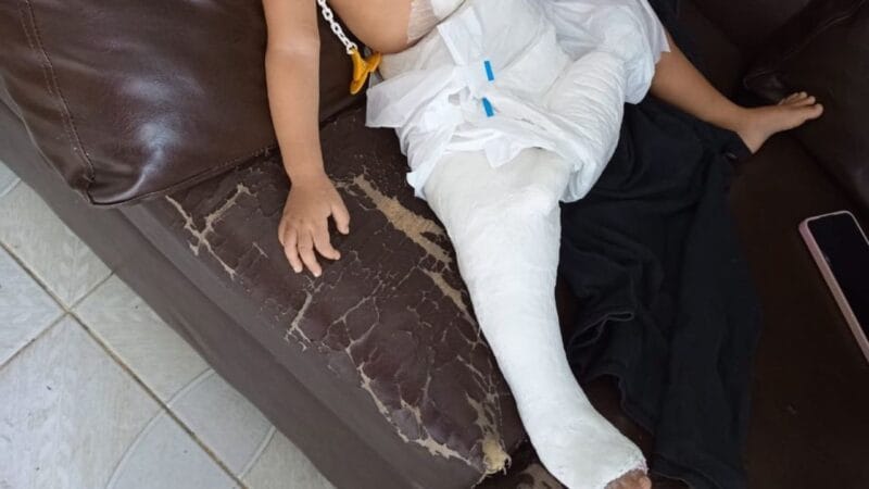 Denúncia de Lesão Corporal em Manaus: Mãe é Acusada Após Filha Sofrer Fratura na Perna