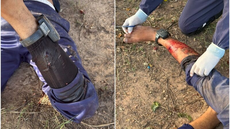 Suspeito Baleado e Preso Após Perseguição Policial em Boa Vista