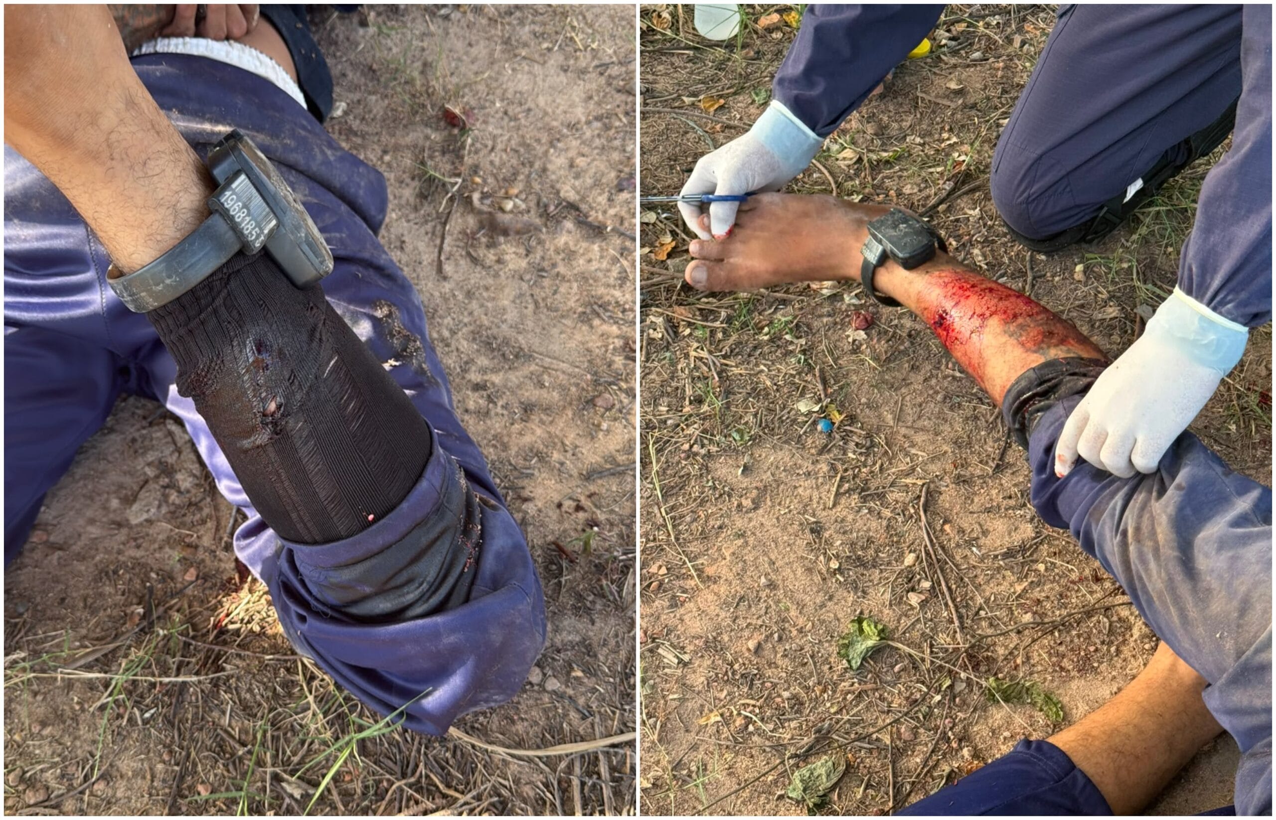 Suspeito Baleado e Preso Após Perseguição Policial em Boa Vista